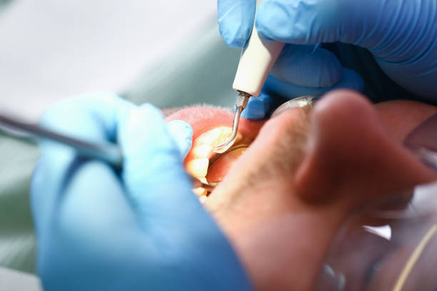 Best Emergency Denture Repair in Bowling Green, MD