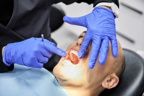 Best Emergency Treatment for Oral Infections in Bowling Green, MD